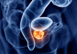Prostate Cancer, Cancer, Theranostics, Prostate Cancer Treatment, Nuclear Medicine